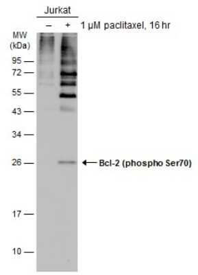 Western Blot: Bcl-2 [p Ser70] Antibody [NBP3-12895] - Untreated (-) and treated (+) Jurkat whole cell extracts (30 ug) were separated by 12% SDS-PAGE, and the membrane was blotted with Bcl-2 (phospho Ser70) antibody (NBP3-12895) diluted at 1:1000. The HRP-conjugated anti-rabbit IgG antibody (NBP2-19301) was used to detect the primary antibody.